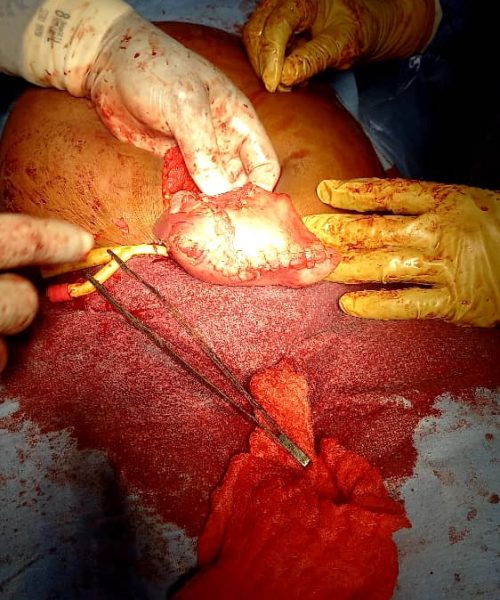 KCare Beyond Borders team delivering surgical care in Nigeria, July 2025